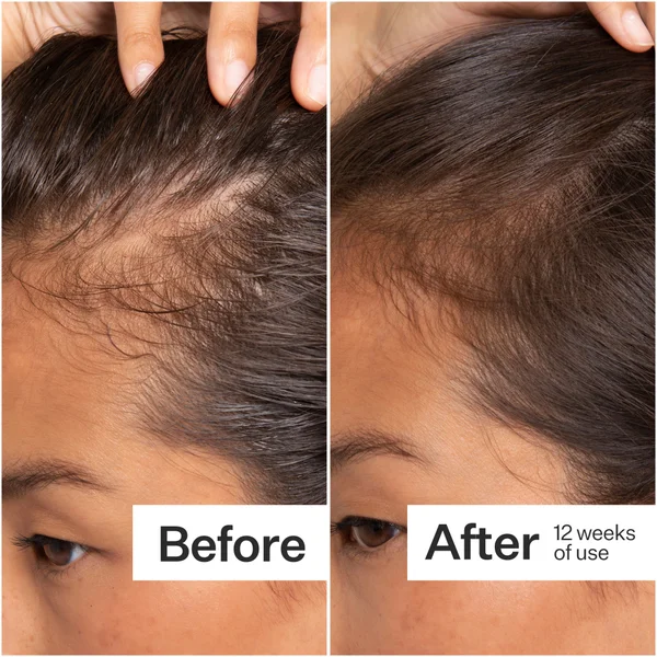 Act+Acre Cold Processed Stem Cell Serum 2.2 Fl Oz