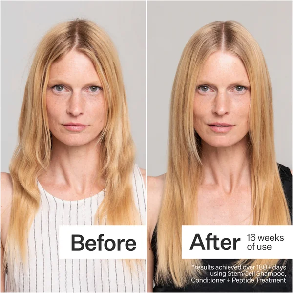 Act+Acre Stem Cell Conditioner For Hair Thinning And Growth 295ml