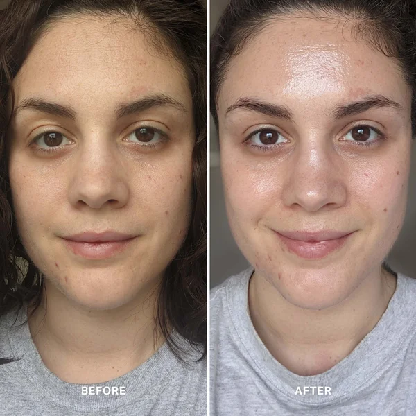 Alpha-H Liquid Gold Exfoliating Treatment With 5% Glycolic Acid 30ml
