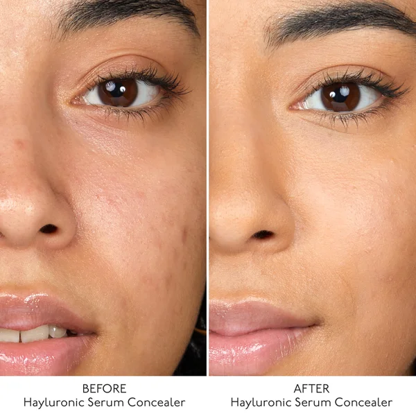 By Terry Hyaluronic Serum Concealer (Various Shades)