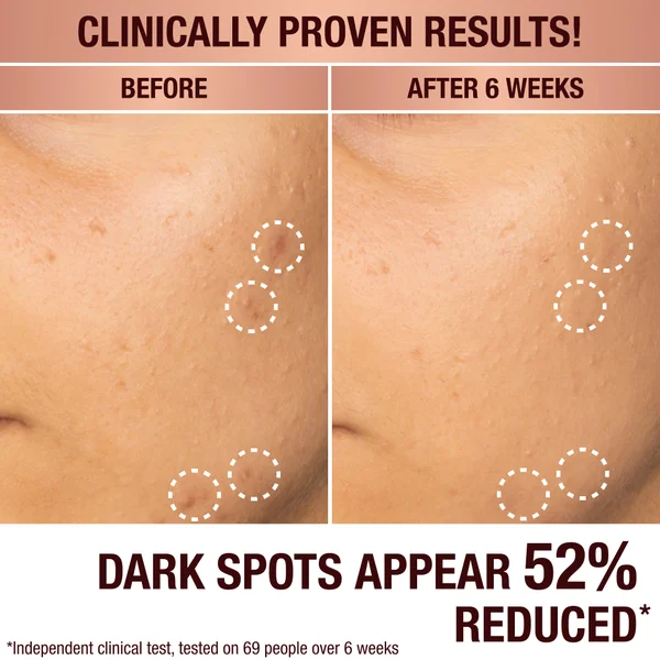Charlotte Tilbury Dark Spots Correcting Radiance Recovery Serum - 10ml
