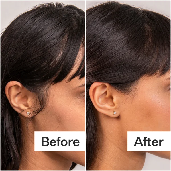 Act+Acre 4% Niacinamide Oily Scalp Serum 65ml