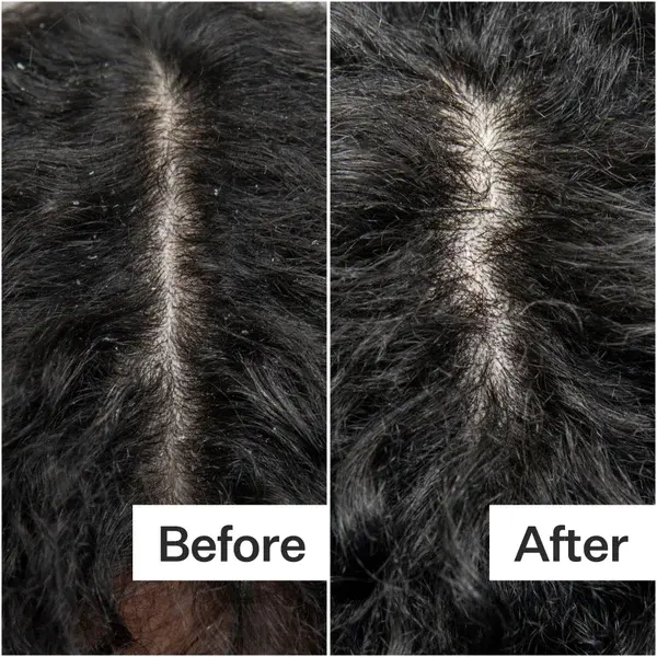 Act+Acre Cold Processed Scalp Detox 3.0 Fl Oz