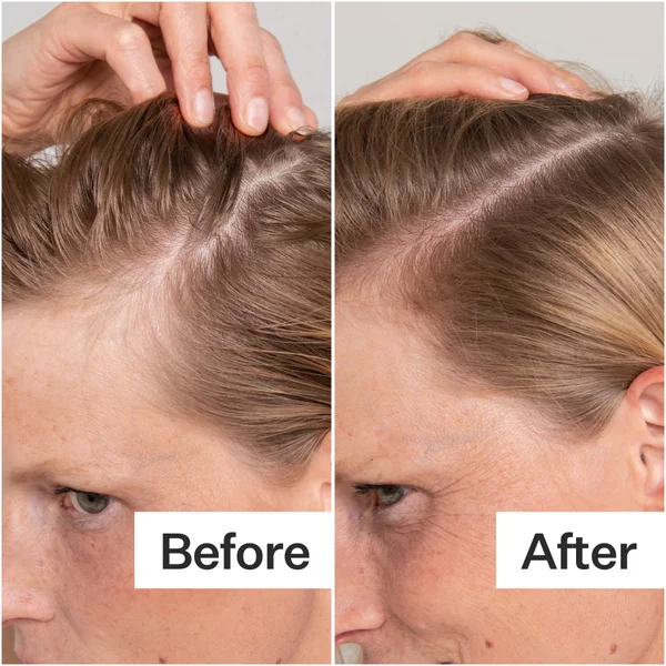 Act+Acre Cold Processed Scalp Renew 2 Oz