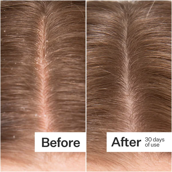 Act+Acre Microbiome Cooling Scalp Serum 65ml