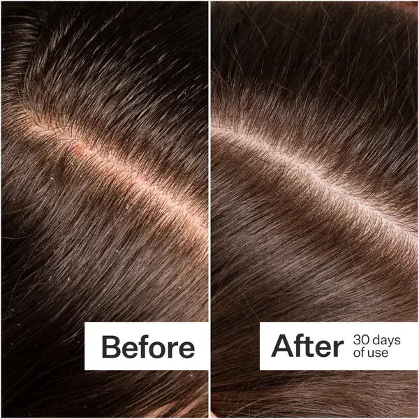 Act+Acre Microbiome Cooling Scalp Serum 65ml