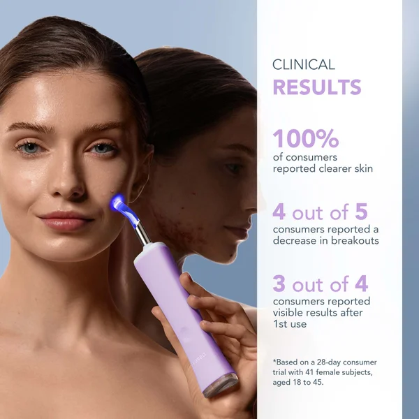 FOREO ESPADA 2 Plus Device - Lavender