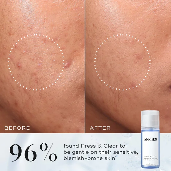 Medik8 Press And Clear Refill 150ml