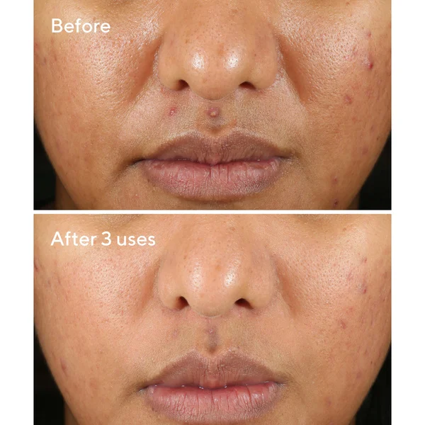 Murad Rapid Relief Sulfur Mask 75ml
