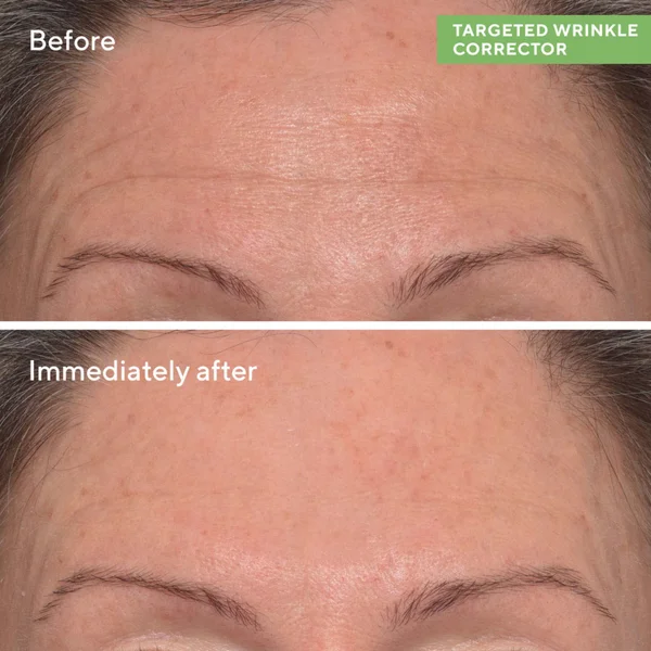 Murad Targeted Wrinkle Corrector 15ml