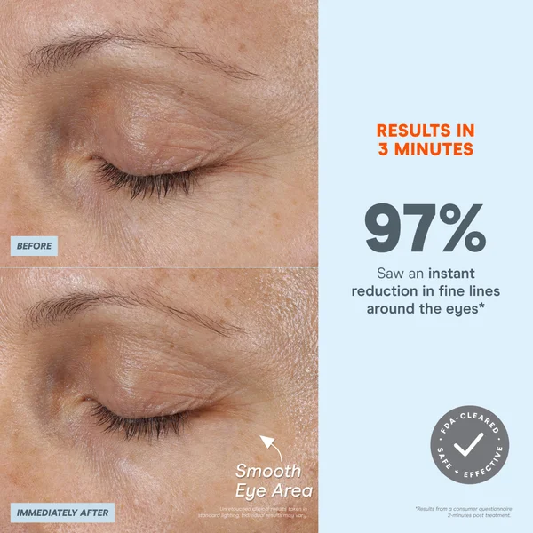 NuFACE FIX Microwand