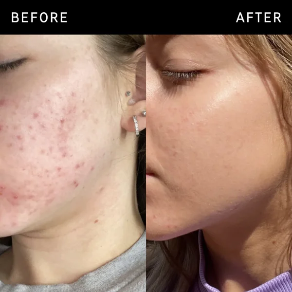 The INKEY List Niacinamide Serum 30ml