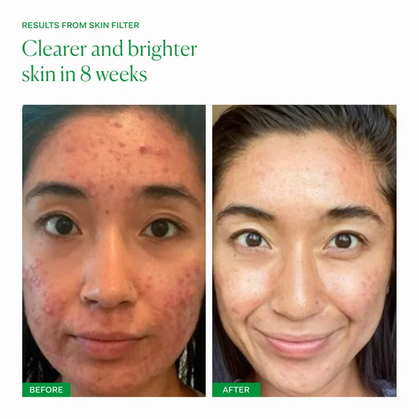 The Nue Co. Skin Filter (30 Capsules)