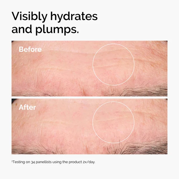 The Ordinary Hyaluronic Acid 2% + B5 60ml
