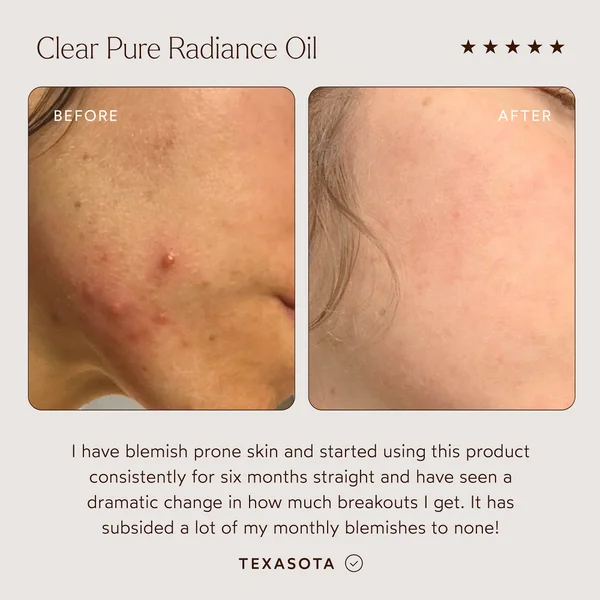 True Botanicals Clear Pure Radiance Oil 30ml