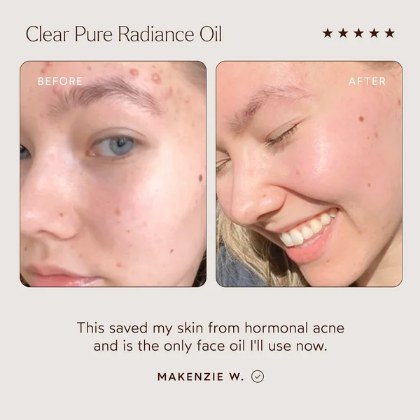 True Botanicals Clear Pure Radiance Oil 30ml