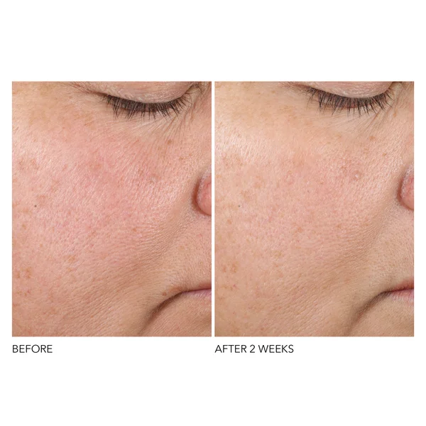 Dr. Dennis Gross Skincare Advanced Retinol And Ferulic Texture Renewal Serum
