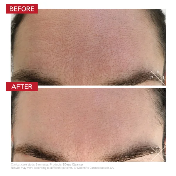 Dr. LEVY Switzerland 3Deep Cell Renewal Micro-Resurfacing Cleanser 150ml
