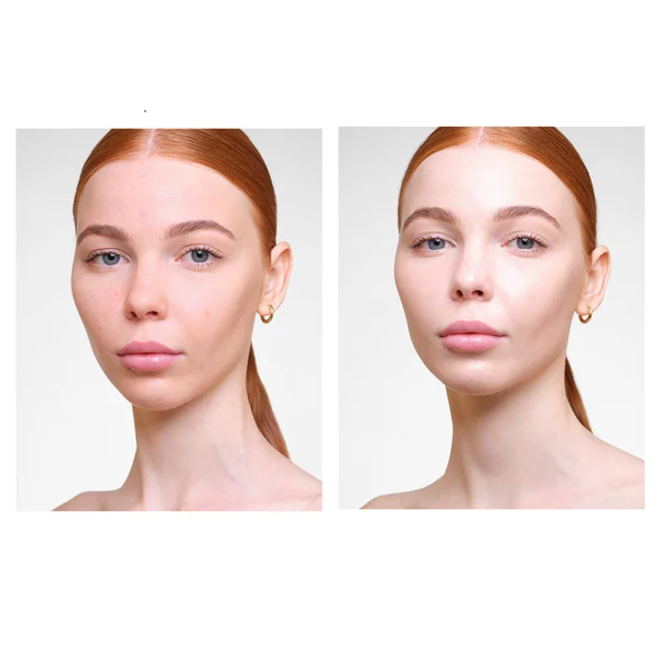 Hourglass Veil Hydrating Skin Tint 35ml (Various Shades)