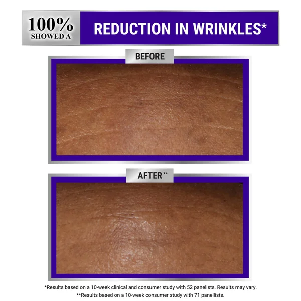 Kiehl's Retinol Skin-Renewing Daily Micro-Dose Serum - 30ml