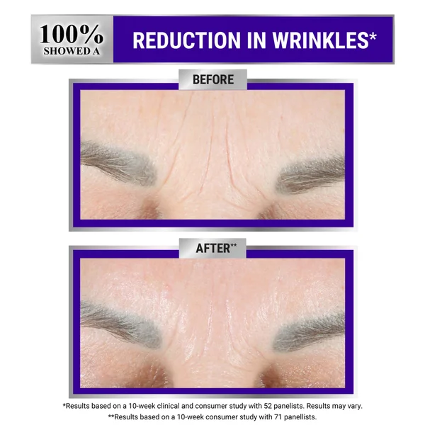 Kiehl's Retinol Skin-Renewing Daily Micro-Dose Serum - 30ml