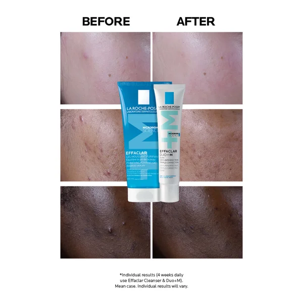 La Roche-Posay Effaclar Duo+M Anti-Blemish Corrective Gel Moisturiser For Oily Blemish-Prone Skin 40ml
