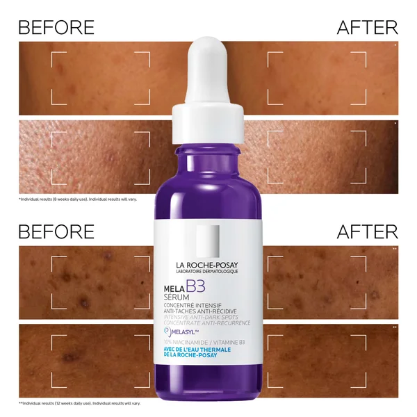 La Roche-Posay MelaB3 Serum: Intense Anti-Dark Spot Serum For Hyperpigmentation 30ml