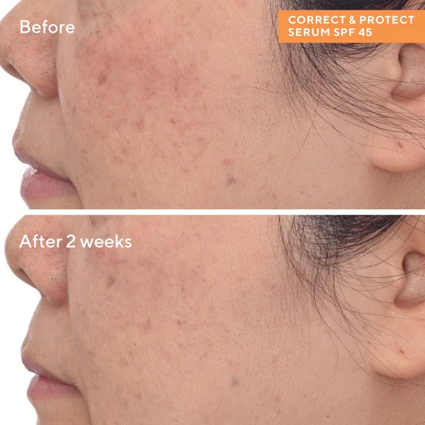 Murad Exclusive Correct And Protect Broad Spectrum SPF45 | PA++++ 30ml