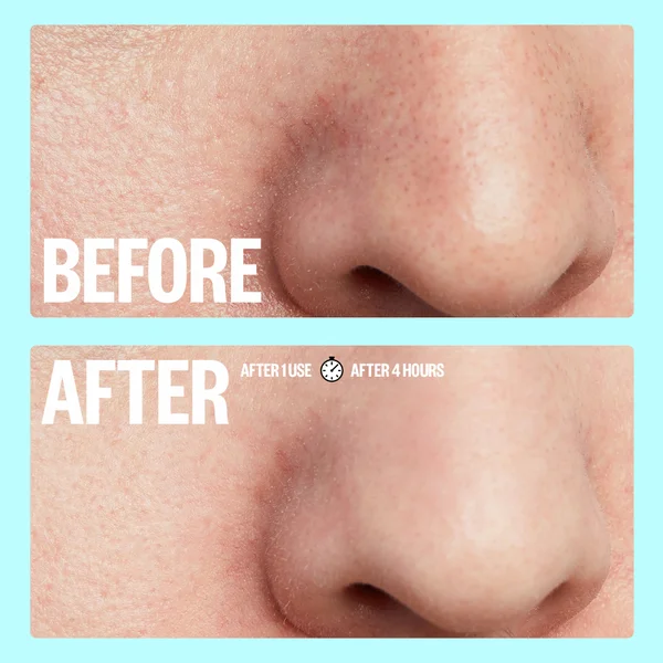 Peace Out Pores 4 Nose Strips And 4 Pore Strips