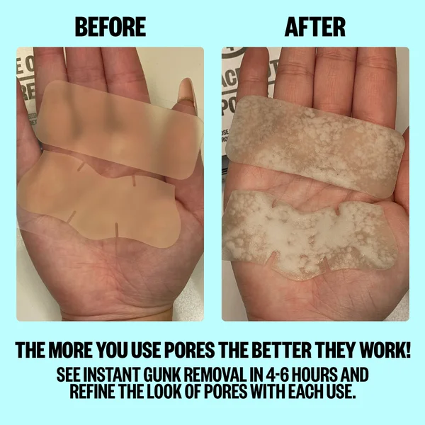 Peace Out Pores 4 Nose Strips And 4 Pore Strips