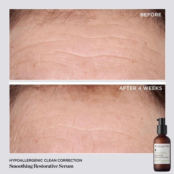 Perricone MD Hypo Clean Correction Smoothing Restorative Serum 2oz FG