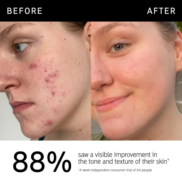 The INKEY List- 15% Vitamin C And EGF Serum 30ml