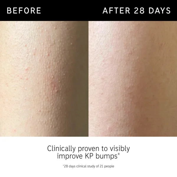 The INKEY List Glycolic Acid Exfoliating Body Stick 45g