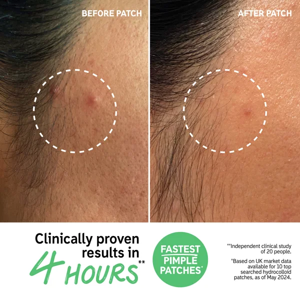 The INKEY List Hydrocolloid Invisible Pimple Patches (22 Patches)