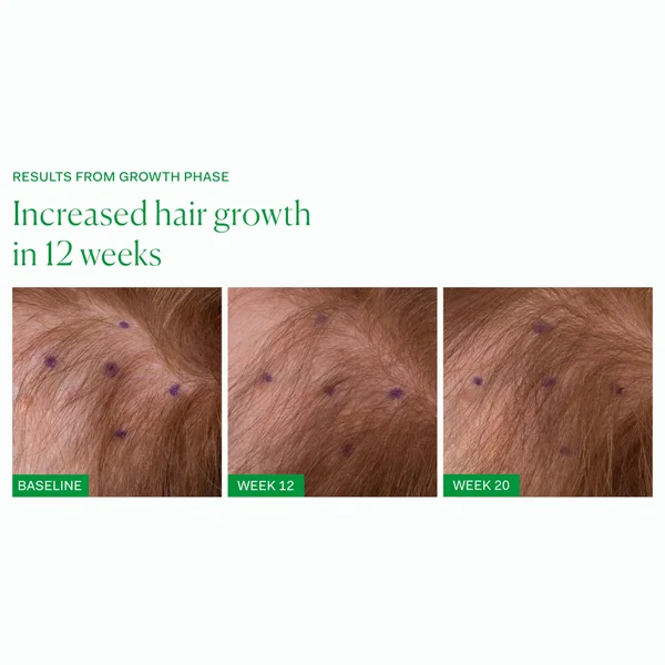 The Nue Co. Growth Phase Hair Supplements (90 Capsules)