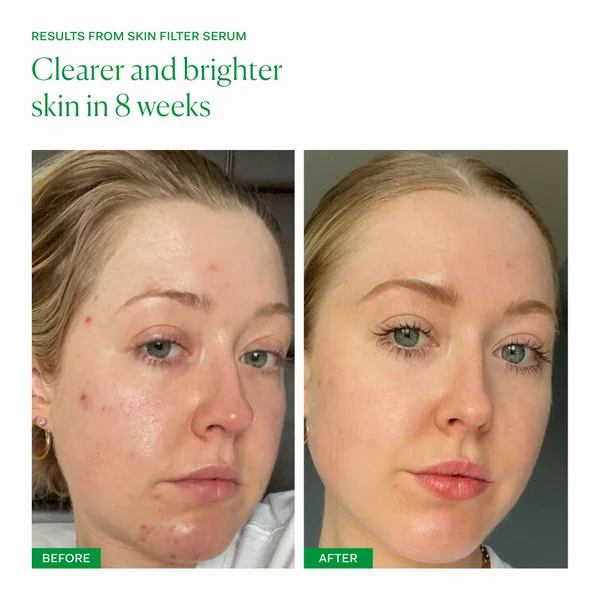 The Nue Co. Skin Filter Daily Brightening Phyto-Retinol + AHA Serum 30ml