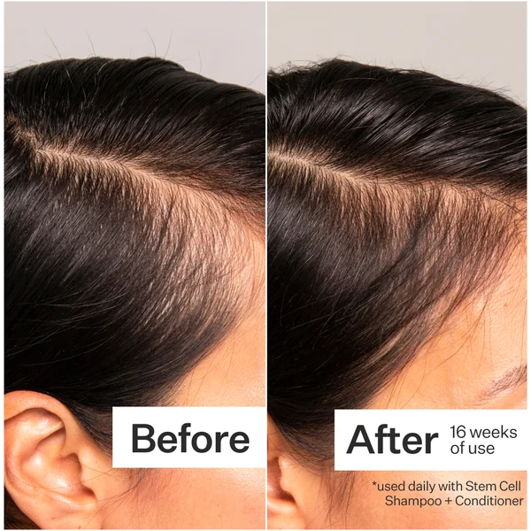 Act+Acre 3% Stem Cell Peptide H3-Grow+ Complex Scalp Treatment For Hair Thinning And Growth 89ml