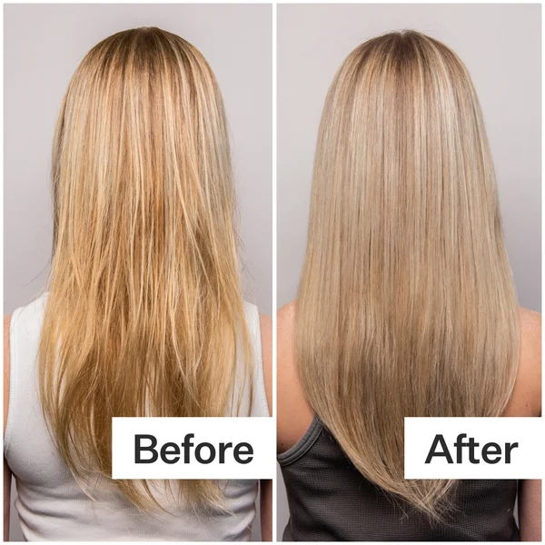 Act+ Acre Clarifying Hard Water Scalp + Hair Treatment 10oz