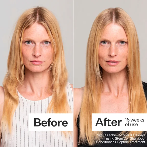 Act+Acre Stem Cell Shampoo For Hair Thinning And Growth 295ml