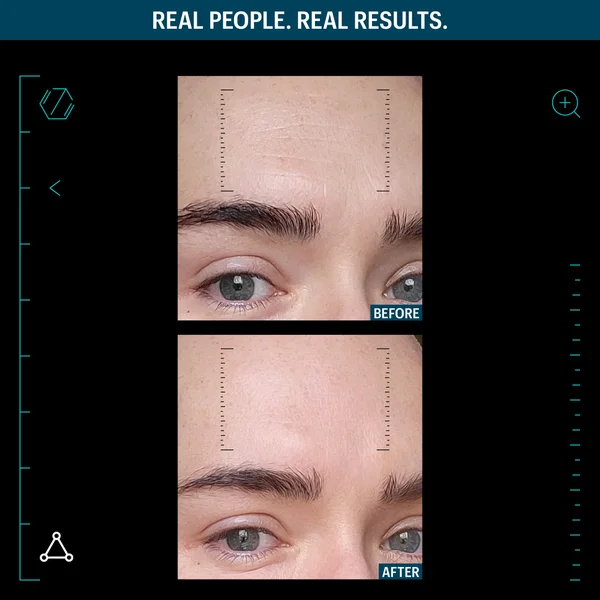 Allies Of Skin Multi Peptides & Growth Factors Advanced Lifting Serum 7ml