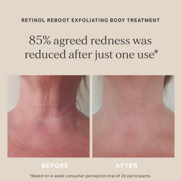 Alpha-H Retinol Reboot Exfoliating Body Treatment With 8% Glycolic Acid 2% Lactic Acid + 1% Encapsuladed Retinol