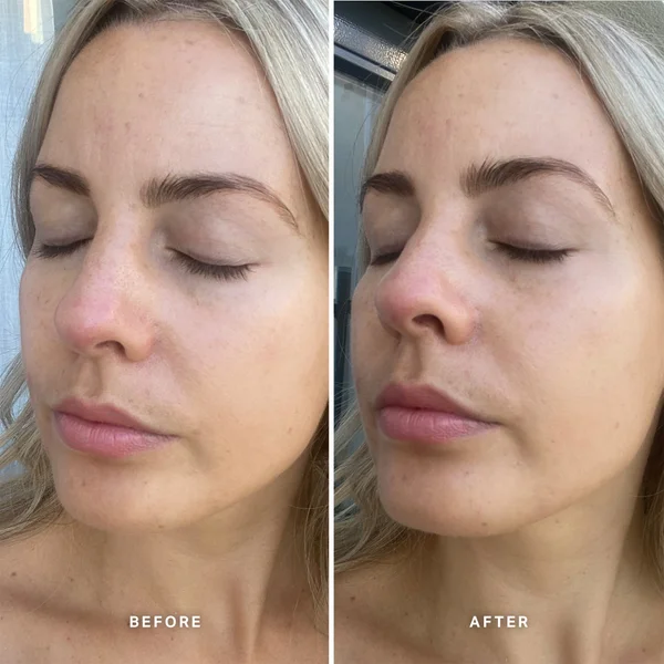 Alpha-H Vitamin E Serum With 1% Ceramide Complex 25ml