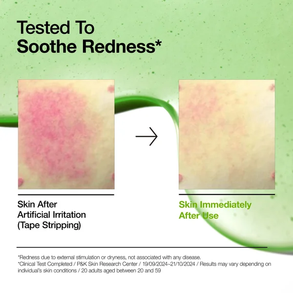 Anua Azelaic Acid 10 Hyaluron Redness Soothing Serum 30ml