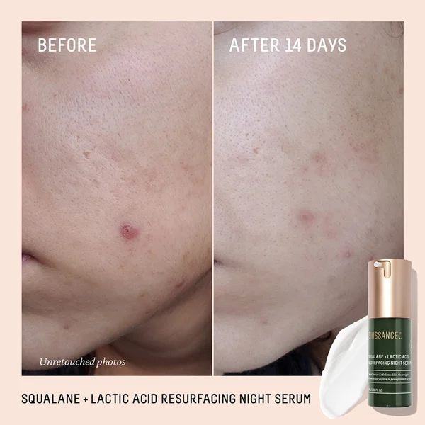 Biossance Squalane And Lactic Acid Resurfacing Serum 30ml