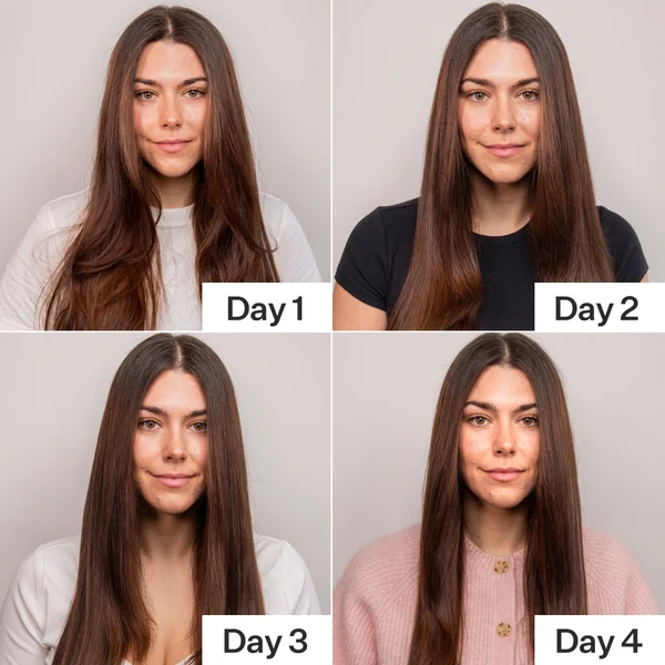 Act+Acre 4% Niacinamide Oily Scalp Serum 65ml