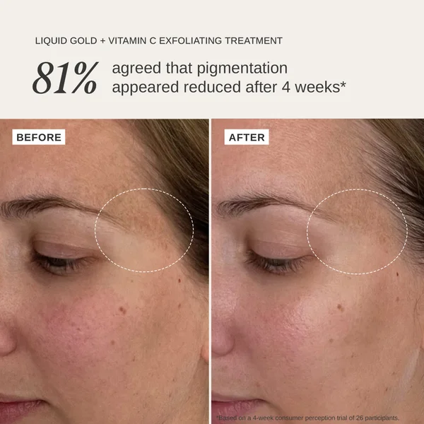 Alpha - H Liquid Gold + Vitamin C Trial Kit