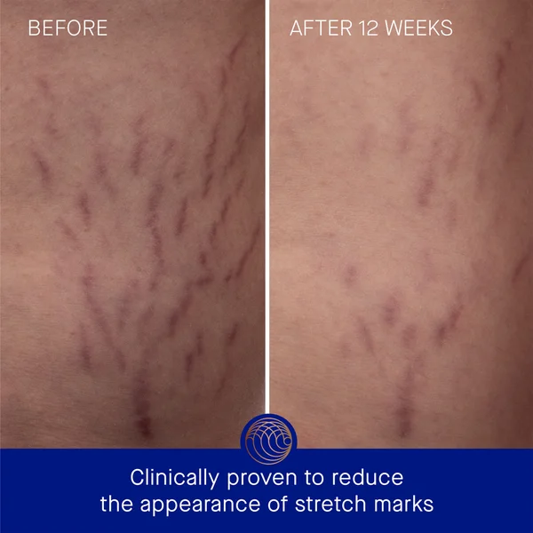 Augustinus Bader The Body Cream 100ml