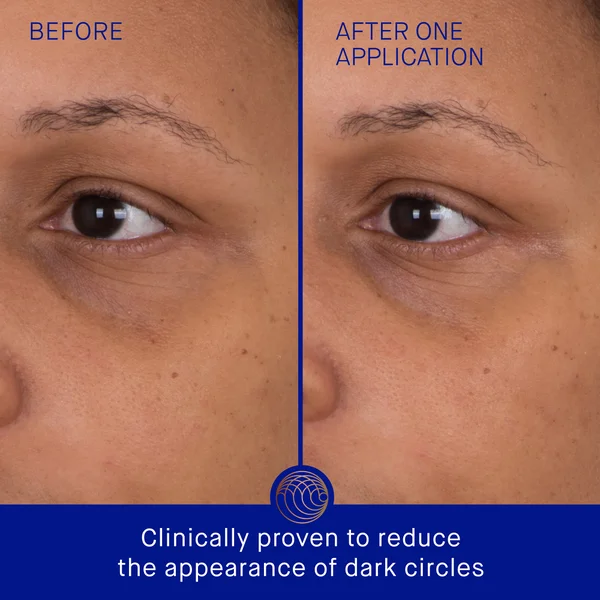 Augustinus Bader The Eye Patches 6 Sachets