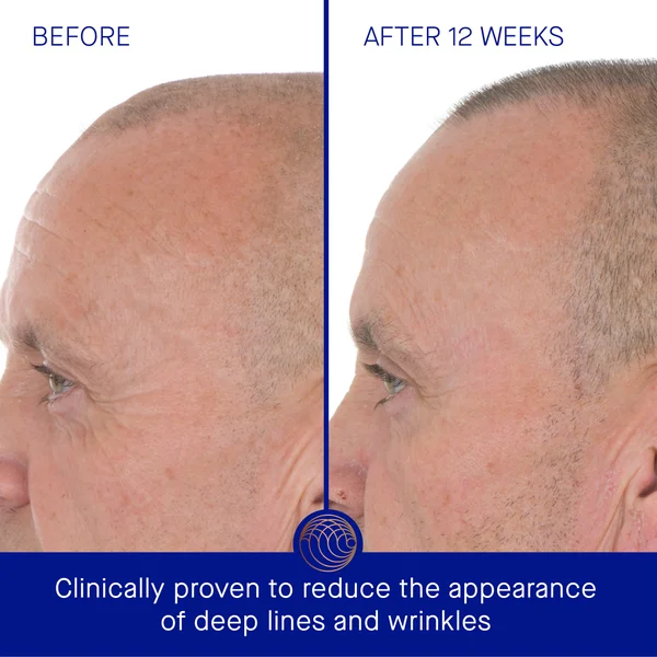 Augustinus Bader The Retinol Serum 30ml