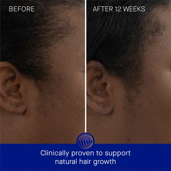 Augustinus Bader The Scalp Treatment 30ml